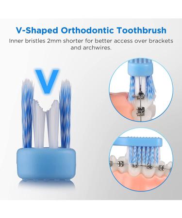 Fremouth V-Shaped Orthodontic Toothbrush for Braces - Soft Bristles - 6 Count (Upgraded) - Buy Online on GoSupps.com