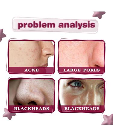 Rosacea Care Rosacea With Natural Moisturizing Fruit Acids Redness Corrector Water Oil Balance Facial Care Improves Skin Relieves Rosacea 30 l - Buy Online on GoSupps.com