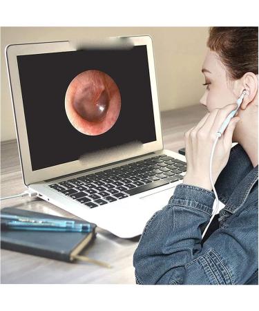 HHWKSJ Ear Wax Removal Soft and Safe Earwax Cleaner Ear Wax Remover with Replacement Heads for Adult Kids Home (Earwax Removal) - Buy Online on GoSupps.com