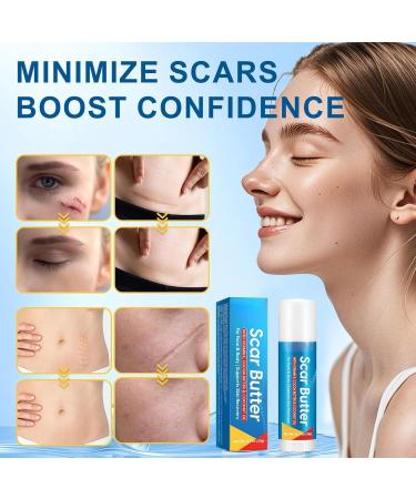 Scar care stick 20g Light NonStick Cream Burn Scars Repair on Body with Butter Stick for Burns Pimples Men Women Daily Travel Face Body - Buy Online on GoSupps.com