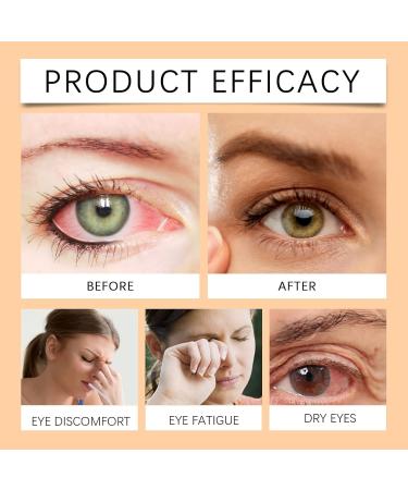 3 Pieces Jimerito Honey Eye Drops Jimerito Honey Eye Drops Stingless Bee Honey Relieves Eye Fatigue and Dryness for Eye Health - Buy Online on GoSupps.com