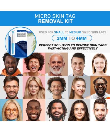 Skin Day Remover Kit - 40 Ligaments & 36 Repair Patches for Small to Medium Skin Tags - Buy Online on GoSupps.com