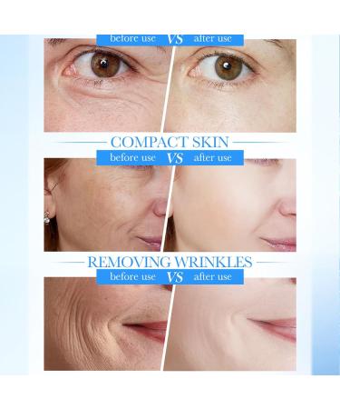 Collagen Anti Wrinkle Face Cream With Retinol Peptides-Anti Aging Face Cream For Mature Skin Face Moisturiser Reduce Fine Lines Lifting And Firming Cream Facial Care - Buy Online on GoSupps.com