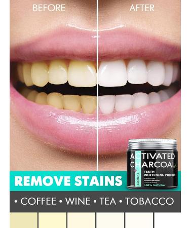 Sunatoria Activated Charcoal Teeth Whitening Powder - Coconut Teeth Whitener for Healthier, Whiter Smile - UK Made, Improved Formula - Buy Online on GoSupps.com
