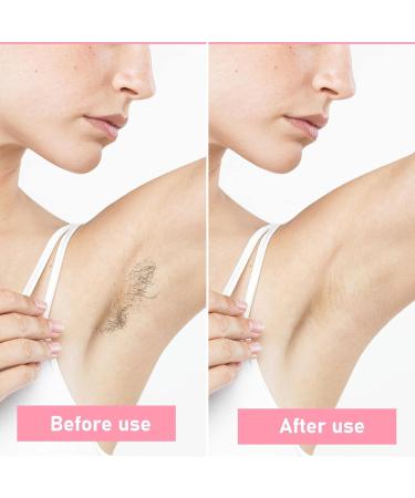 Jinlaili Women's Epilator - LED Hair Removal for Body Face Armpit & Bikini - Battery Operated (Not Included) - Smooth Skin Anywhere - Buy Online on GoSupps.com