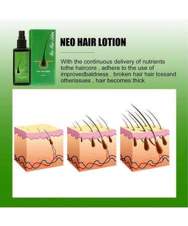  Huien Huien Hair Growth Serum for Men and Women 120 ml Hair Regrowth Lotion and Hair Growth Care DHT Blocker - Buy Online on GoSupps.com