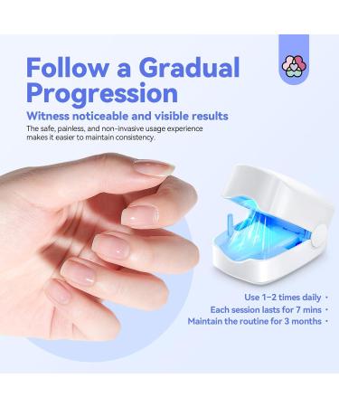 Saviland Nail Fungus Treatment Device | Effective Cold Laser Therapy for Onychomycosis | Portable & Rechargeable Nail Care Solution - Buy Online on GoSupps.com