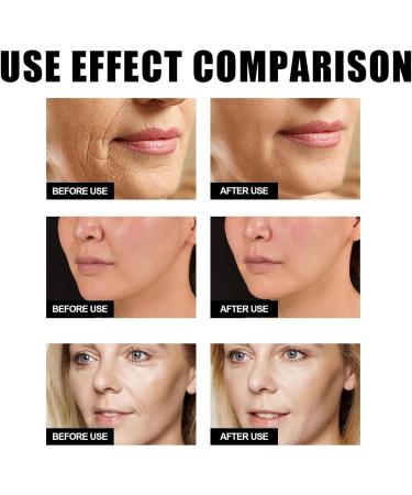 Hydro Boost Hyaluronic Acid Face Moisturizer Natural Hyaluronic Acid Day and Night Moisturizer Face Care Face Moisturizer Face Care 50ml (1PC) - Buy Online on GoSupps.com