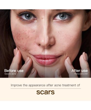 Madagascar Centella Facial Serum for face Natural Extraction of Bakuchiol Centella Asiatica Extract for Soothing Sensitive& Acne-Prone Skin for Scars Moisturizing& Firming- 45ml - Buy Online on GoSupps.com
