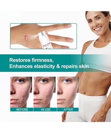 Scar Spray 2pcs Stretch Mark Care 20g - Gentle Skin Care & Scar Removal Spray - Buy Online on GoSupps.com