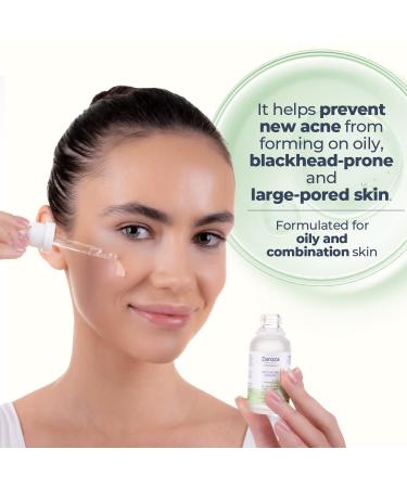 Anti-Acne Serum with Salicylic Acid & Niacinamide | Prevent Breakouts & Balance Skin Tone | 1 fl oz - Buy Online on GoSupps.com