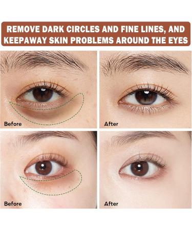 CAHIUYOA Eye Cream for Dark Circles and Puffiness Firm That Delicate Skin Under Your Eyes - Buy Online on GoSupps.com