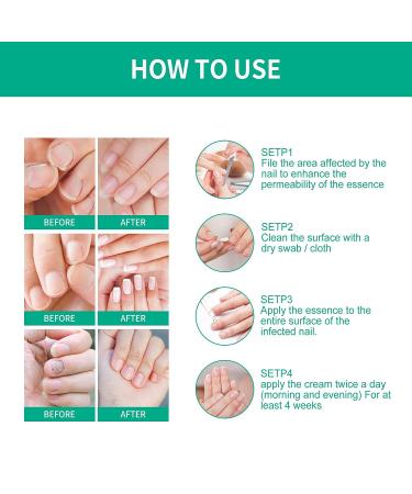 Kerassentials Toenail Treatment - Extra Strength for Damaged & Discolored Nails (3pcs) - Buy Online on GoSupps.com