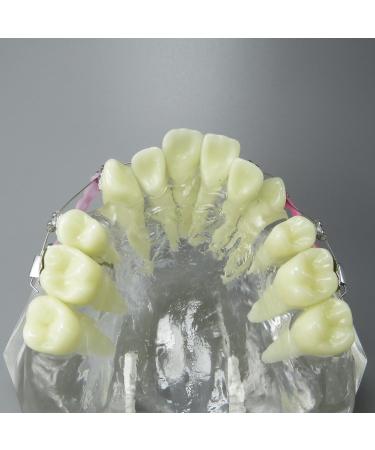 Shop Dental Malocclusion Orthodontic Treatment Model - Metal Brackets & Colorful Ties | M3005 - International Shipping Available - Buy Online on GoSupps.com