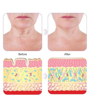 Anti-Wrinkle D collet Pad | Reusable Silicone Pads for Breast Wrinkles | Overnight Wrinkle Smoothing Treatment - Buy Online on GoSupps.com