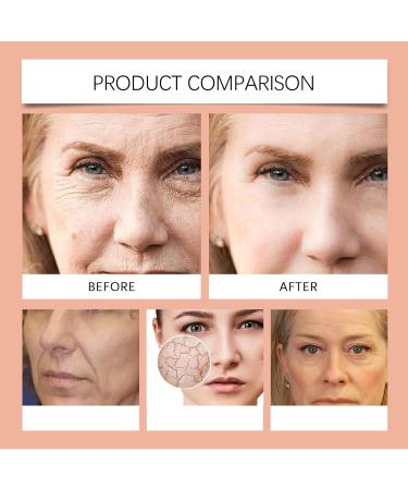  WRANBAO Wilde Parakresse Facial Oils - Enhances Skin Radiance - Moisturizing Facial Oil - Nourishes and Smoothes Fine Lines Moisturizing - Face Serum - For Most Oils - 5 Pack - Buy Online on GoSupps.com