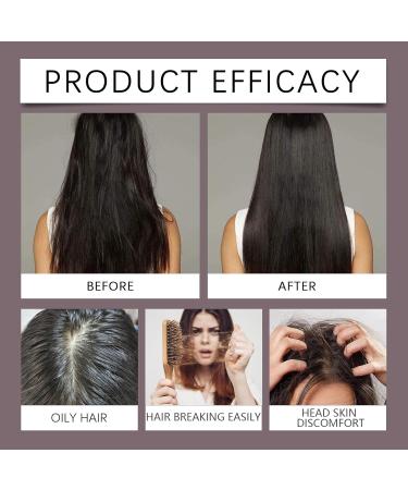  homomdy 3 in 1 Onion Rosemary Shampoo for Hair Growth Reduces Hair Loss and Hair Breakage Deep Cleanses & Moisturizes (1 Piece) - Buy Online on GoSupps.com