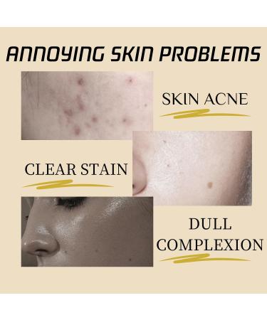 Turmeric & Kojic Acid Face Exfoliator Pad - Cleansing Pads - Gentle Face Toner Pads - Brighting Skin Exfoliating Pads - Exfoliating Face Pads Fade Acne Nourish Face Care - Buy Online on GoSupps.com