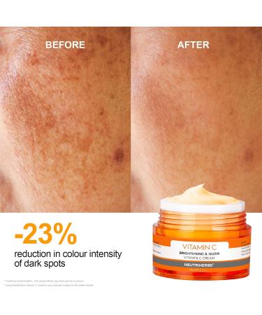 Neutriherbs Vitamin C Face Cream - Day & Night Moisturizer for Soft Smooth Skin | 1.7oz #1 Vitamin C Cream - Buy Online on GoSupps.com
