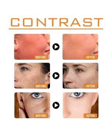 Face Sunscreen SPF 100 SPF Moisturizer Lightweight under Makeup Travel Essentials Summer Essentials Skin Care Sunscreen - Buy Online on GoSupps.com