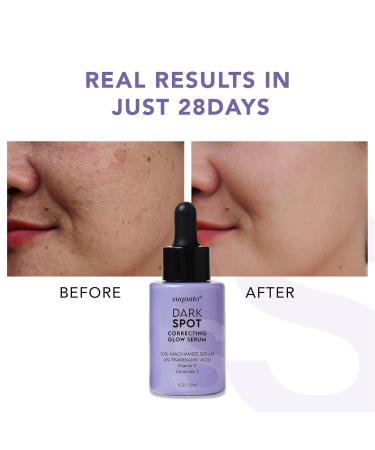 suquato Dark Spot Remover Serum For Face Hyperpigmentation & Melasma Care Brightening & Dark Spot Correcting Glow with Tranexamic Acid + Niacinamide + Vitamin C (30ml) - Buy Online on GoSupps.com