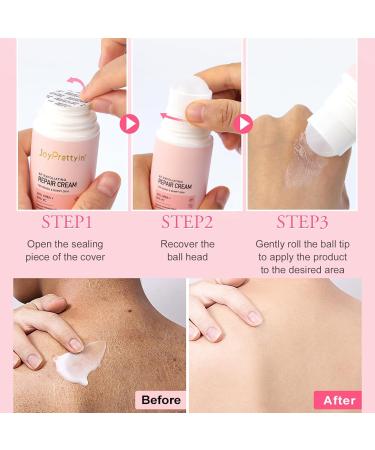 Keratosis Pilaris Lotion Leg Keratosis Pilaris Treatment Body Cream Skin Exfoliating Repair Cream Chicken Skin Care Cream Exfoliating Skin Body Lotion for Reduce and Smoothen Rough & Red Bump - Buy Online on GoSupps.com