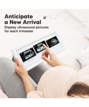 Sonogram Picture Frame Trio - Ultrasound Frames for Mom to Be - Baby Nursery Decor - Pregnancy Announcement Gift - Pregnant Mom Gifts (Alpine White) - Buy Online on GoSupps.com