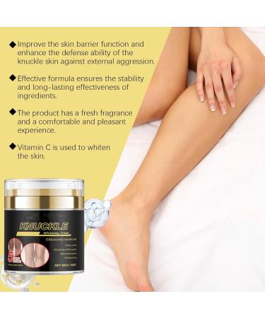 Skin Care 5days Dark Knuckle Remover Whitening Cream Anti Spot Face Cream Dark Spot Correcting Serum- Skin Brightening Gel Cream for Sun Spots with Hyaluronic Acid Vitamin E (2) - Buy Online on GoSupps.com
