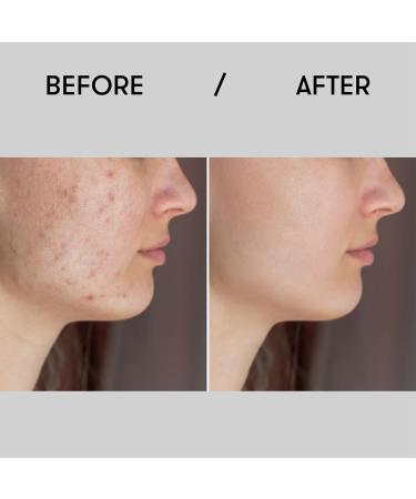 Sane Hydrating Face Toner - Calming & Revitalizing 8.45 fl oz | Deep Moisturizer for Facial Skin | International Shipping Available - Buy Online on GoSupps.com