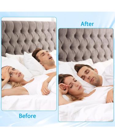 Anti Snoring Devices for Sleep Anti Snoring Mouthpiece Anti Snoring Mouth Guard Stop Sleeping Snore Snoring Solution - Buy Online on GoSupps.com