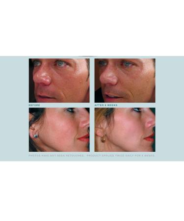 Buy Anti Aging Face Cream - Triple Antioxidant Serum with Resveratrol Green Tea & Caffeine - Reduces Redness & Soothes Sensitive Rosacea Skin - 1oz - Buy Online on GoSupps.com