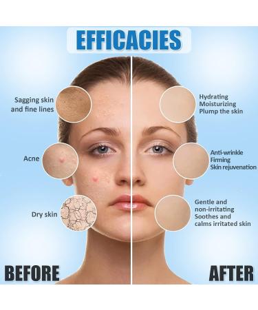 Hydro Jelly Mask Powder for Professional Skincare | Vegan & Hydrating Facial Mask with Hyaluronic Acid - 17.6Fl Oz Paraben & Fragrance Free - Buy Online on GoSupps.com