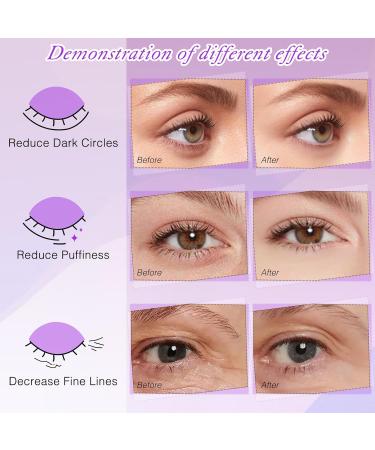 LZM Under Eye Gel Patches Natural Gel Eye Masks Under Eye Treatment Masks for Dark Circles Anti Wrinkle Puffy Eyes (Green Pink Gold) - Buy Online on GoSupps.com