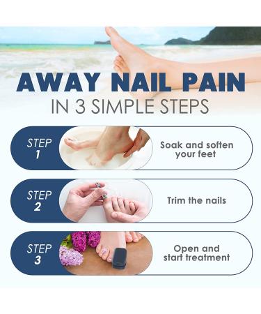 Blue Nail Fungus Laser Treatment Device- Clip-on Design, Targets Damaged Toenails - Buy Online on GoSupps.com