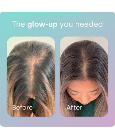 Biosil Advanced Hair + Nail Care - Growth Vitamins for Women - Strengthen & Thicken Strands - 60 Capsules - Patented ch-OSA - 30-Day Supply 60 Count (Pack of 1) - Buy Online on GoSupps.com