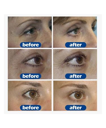 Best Eye Cream for Dark Circles & Puffiness | Collagen Hydrating Treatment for Wrinkles & Fine Lines - Day & Night Formula for Men & Women - Buy Online on GoSupps.com