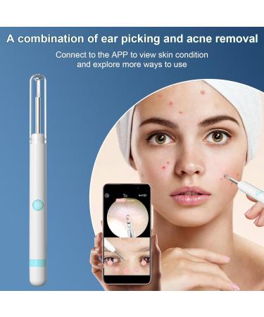 Premium Ear Wax Removal Tool with 1080P HD Camera & LED Light Complete Ear Cleaning Kit for iOS & Android - Buy Online on GoSupps.com