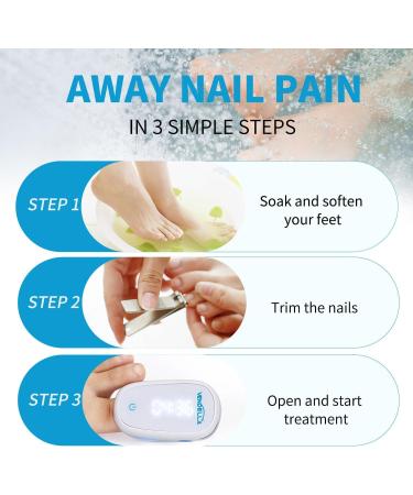 Nail Fungus Laser Treatment Device - Onychomycosis Laser Nail Treatment - Effective | Safe Rechargeable Laser Treatment at Home for Unattractive Discolored Damaged Nails - Buy Online on GoSupps.com