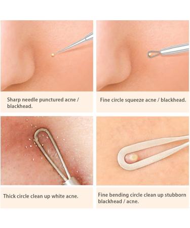 Blackhead Remover Tool Kit - FEITA Acne Pimple Tweezers Comedone Extractor Blemish Removal Tool Set for Facial Whitehead Popping Zit Removing - Buy Online on GoSupps.com