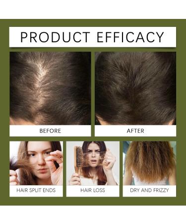  homomdy Natural Rosemary Oil for Hair Growth Hair Growth Serum with Coconut and Rosemary Oil Nourishing for Dry and Damaged Hair Anti Hair Loss and - Buy Online on GoSupps.com