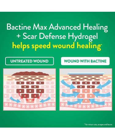 Bactine MAX Advanced Healing & Scar Defense Hydrogel 0.75oz | First Aid Wound Care - Buy Online on GoSupps.com