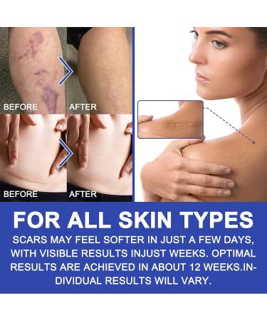 Clear Gel Silicone Scar Tape (1.6'' x 120') for Scar Removal - C-Section Surgery, Keloid, Burn, Acne - Silicone Scar Sheets Strips - Buy Online on GoSupps.com