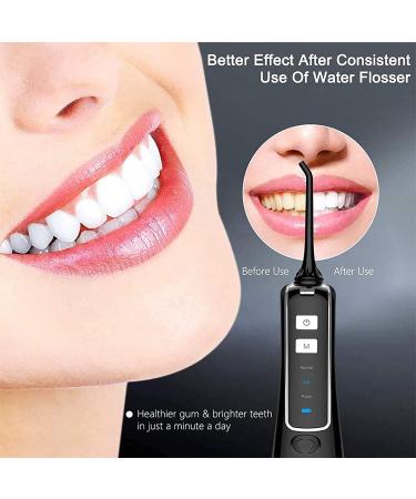 GeRRiT Cordless Water Flosser | IPX7 Waterproof Dental Oral Irrigator | 3 Modes & Detachable Tank for Travel & Home Use - Buy Online on GoSupps.com