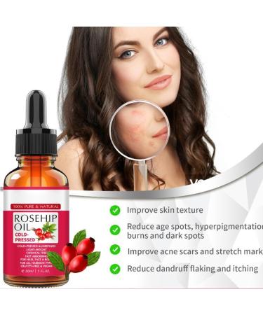 Rosehip Oil for Face 30ml - 100% Pure Organic Cold-Pressed Rose Hip Oil for Skin Body and Hair Natural Rosehip Seed Oil Nourishes and Hydrates for All Skin Types - Buy Online on GoSupps.com