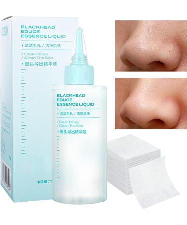 Nose Skin Cleansing Liquid Nose Skin Dirt Extraction Liquid 150ml With Pads NonGreasy Refreshing Facial Care For Women - Buy Online on GoSupps.com
