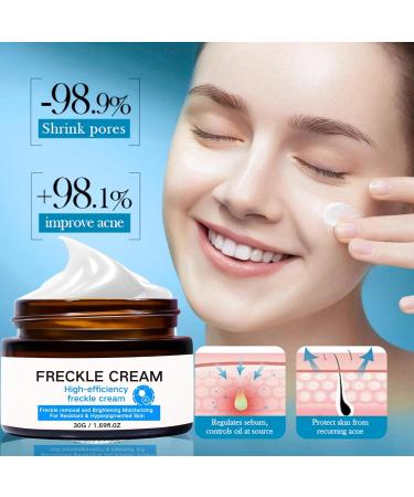 IZBEAUVO Dark Spot Remover for Face and Body Freckle Removal Cream Pigmentation Removal Cream Dark Spot Corrector Cream for Sun Spots Melasma Freckle Dark Spot Sun Spot Age Spot - Buy Online on GoSupps.com