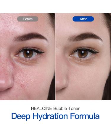 Healoine Bubble Toner Deep Moisturizing Hydrating and Refreshing Cloud Glow Toner for Face Nature Vegan Korean Skin Care 180ml/6.1 fl.oz. - Buy Online on GoSupps.com