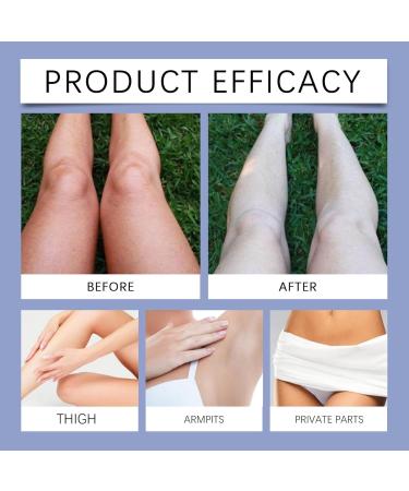 Intimate Area For Dark Spot Correction Armpit Underarm Armpit Elbow Inner Thigh And Knee Oisturizing Skin Dark Spot Remover For Sun Spots (3) - Buy Online on GoSupps.com