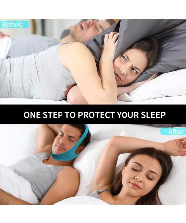 Babyfond Upgrade Anti Snore Chin Strap - Adjustable & Breathable Sleep Aid for Men Women - Stop Snoring CPAP Users - Larger Jaw Support Belt (Blue) - Buy Online on GoSupps.com