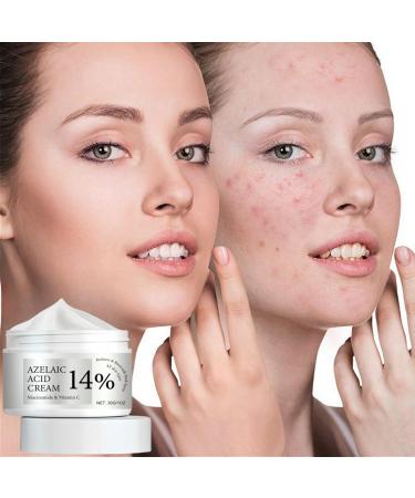 Azelaic Acid Cream Azelaic Acid Serum Cream 14% Azelaic Acid Serum Face Cream with Niacinamide & Vitamin C Anti Redness Cream Reduce Blemishes Remove Acne&Rosacea Shrink Pore for All Skin Types - Buy Online on GoSupps.com